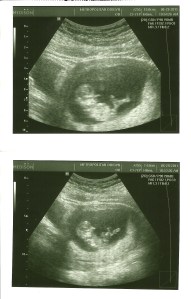 Baby Larson 12 Weeks